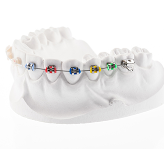 farbige Brackets